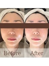 凪眠/小顔リンパフェイシャルの効果79