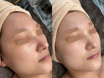 リボーン 柏(REBORN)/毛穴レスな素肌は清潔感の証