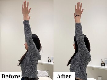 ソレア(Solea)/肩こり・巻き肩改善1回目