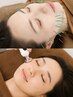 【美容鍼】人気No.1!☆最強エイジングケア☆美容鍼BIO電流エステ70分