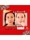 アン 銀座(ann)の写真/《東銀座駅徒歩1分》美容業界で注目のレッドショット。お肌のハリUP!!透明感、肌質◎空圧で導入