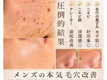 エヌエクラ(N.eclat.)の雰囲気（メンズ毛穴改善）