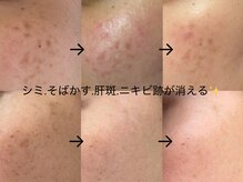 レヴィア(Revia)
