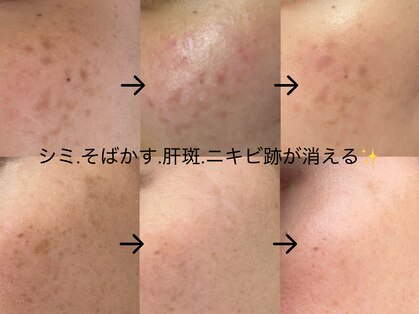 レヴィア(Revia)の写真