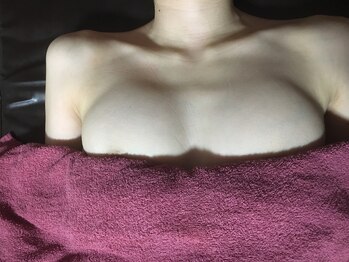 アンジェリークBB バストパレット本店/☆施術