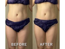 ヒトハナ(hitohana)/より細く◎