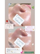 クレヴィー(Creviy)/3D毛穴洗浄×ハーブピーリング