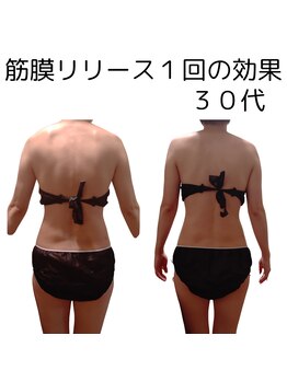 フロレゾン(Floraison)/ゆがみケア・筋膜リリース