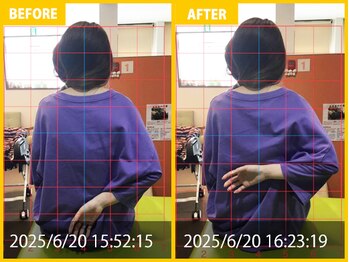 整体院 元 宇城松橋店/腰痛、膝の動作時痛の悩み