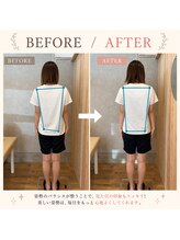 美整庵 谷山店(BISEIAN)/姿勢改善 小顔矯正before after 