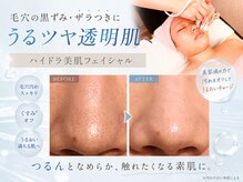 ライトウェーブ 諏訪インター店の雰囲気（フェイシャルエステ/毛穴ケア/毛穴吸引/ハイドラ美肌）