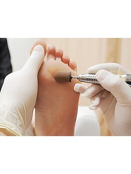 角質ケアができるサロン