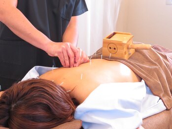 高田鍼灸カイロプラクティック/鍼灸で身体がゆるゆるに★