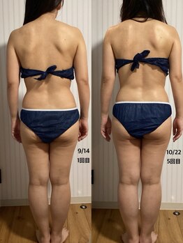 オリス(ORRIS)/ビフォーアフター