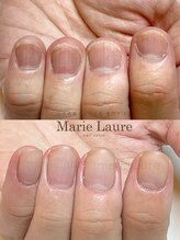 マリーロール 梅田店(Marie Laure)/深爪矯正/自爪育成/自爪風