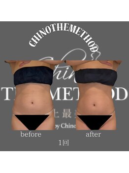 エミナル(EMINALu)/内臓を活性化