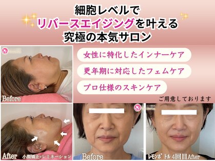 アンリエッタ(Unlieta)の写真