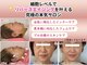 アンリエッタ(Unlieta)の写真