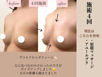 ソワ(soie)/左右差特化！ブラの隙間が埋まる