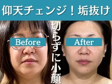 フローフシ∞
