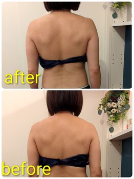 ヨサパーク アカーシャ(YOSA PARK AKASHA)/1回でも変わる肩甲骨