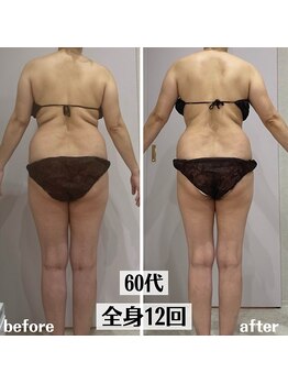 グラチア(Gratiae)/