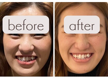 クク 赤坂 天神(99 KUKU)の写真