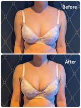 ククナ 上越店(KUKUNA)/★バストアップビフォーアフター