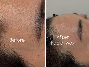 ビオトーン バイ ツリー(biotone by TREE)の写真/【西荻窪駅から徒歩５分】あなただけのほっとできる居場所がここに！周りが憧れる透明感すっぴん肌へ♪