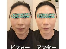 プチリュクス(Petit Luxe)の雰囲気（【小顔リフトUP】ツボと筋膜刺激★ヘッド・デコルテリンパ付き！）
