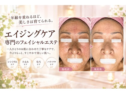 ピュリフィケーション(Purification)の写真
