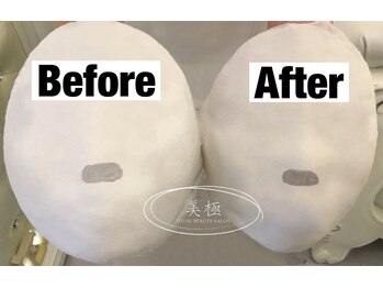 美極 トータルビューティー(美極 TOTAL BEAUTY)/恵比寿/小顔コルギ/エステ/