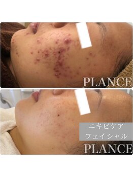 プランス 渋谷(PLANCE)/PLANCE大人気メニュー!