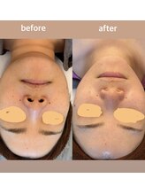 サロン ド ミニョン(salon de mignon)/衝撃☆☆ビフォーアフター♪