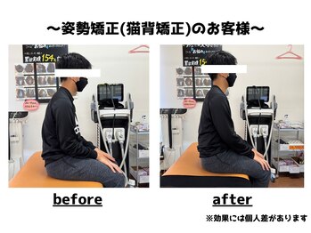 トータルビューティーみつとも/姿勢矯正/猫背矯正