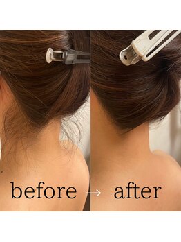 エムズワン 都ホテル店(M'S ONE)/襟足シェービングbefore→after