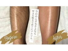 メローワックス 宮崎店(MELLOW WAX)の雰囲気（Wax脱毛でスッキリ！古い角質も除去できてツルツルになれます。）
