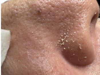 サラグランデ(Sara Grande)/男性毛穴ケア急増中!脂臭撃退♪