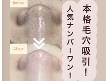 ルイスラグジュアリー(LOUIS LUXURY)の雰囲気（《実感！鼻の黒ずみ除去！真の毛穴レスへ》本格毛穴吸引￥9,980）