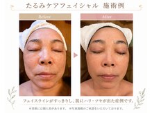 エステティックリゾート オルオル(oluolu)