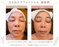 エステティックリゾート オルオル(oluolu)