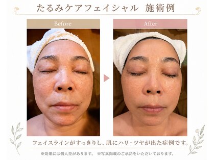 エステティックリゾート オルオル(oluolu)の写真