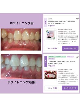 エイチ アンド イー(H&E)/