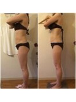 ビューティーワークスシャンティ 柏店(Beauty Works Shanti)/キャビラジインドマッサージ