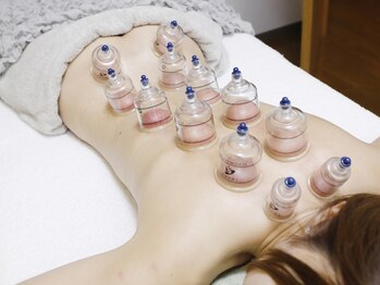 レミリア(REMIRIA)/全身カッピング