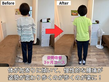 東林間整骨院/姿勢が良くなり腰痛が緩和