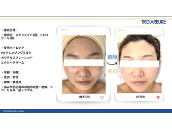 リトルーム(Litroom: from Seoul)/スキンメイド