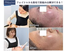 ベルミーランド 浜松天王の雰囲気（脱毛＆フェイシャルで美肌に！お肌のお悩みはサロンで解決◎ ）