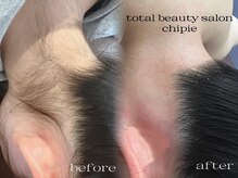 シピ 水戸店(Chipie)/うなじWax