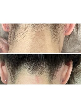 特別な日の1dayメニューがあるサロン